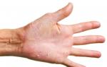 Рецепты для кожи рук Что сделать чтобы руки были мягкие